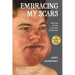 Embracing My Scars: A journey of hope in the face of adversity