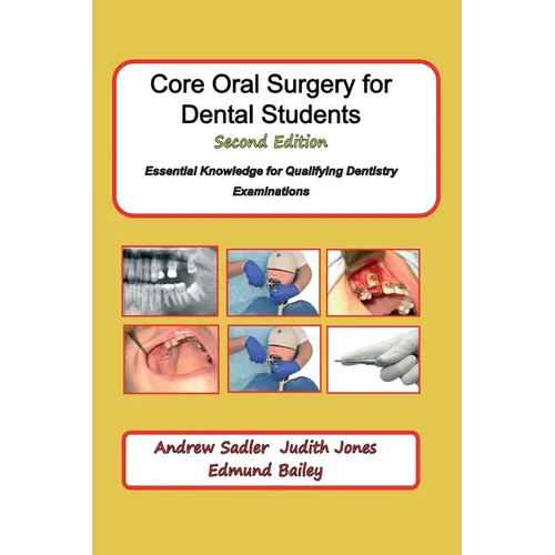 Core Oral Surgery for Dental Students Second Edition: Essential Knowledge for Qualifying Dentistry Examinations