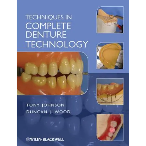 Techniques in Complete Denture