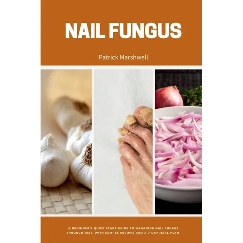 Nail Fungus: A Beginner's Quick Start Guide to Managing Nail Fungus Through Diet, With Sample Recipes and a 7-Day Meal Plan