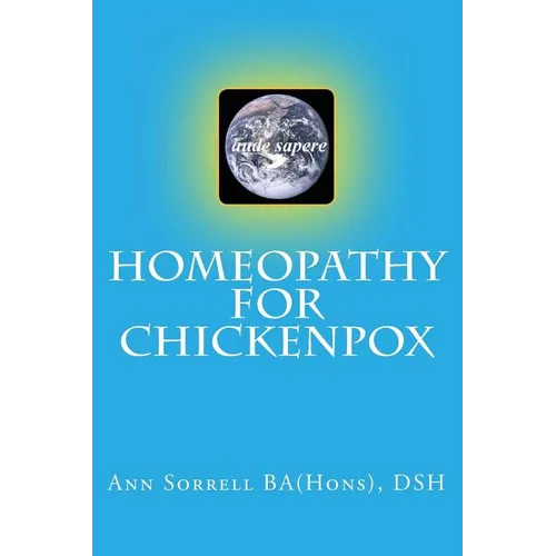 Homeopathy for Chickenpox