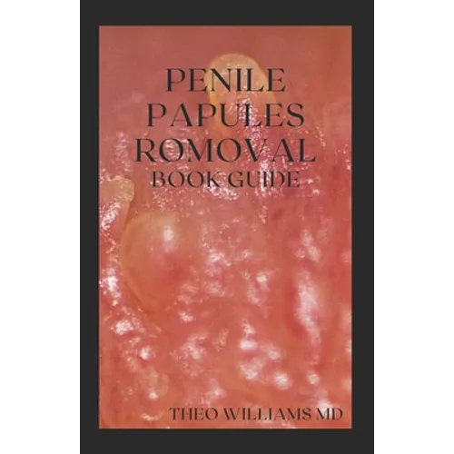 Penile Papules Romoval Book Guide: The Ultimate Guide On How To Remove Pearly Penile Papules Using Natural Remedies