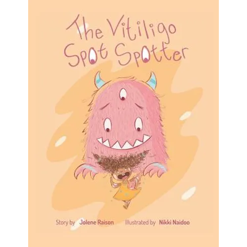 The Vitiligo Spot Spotter
