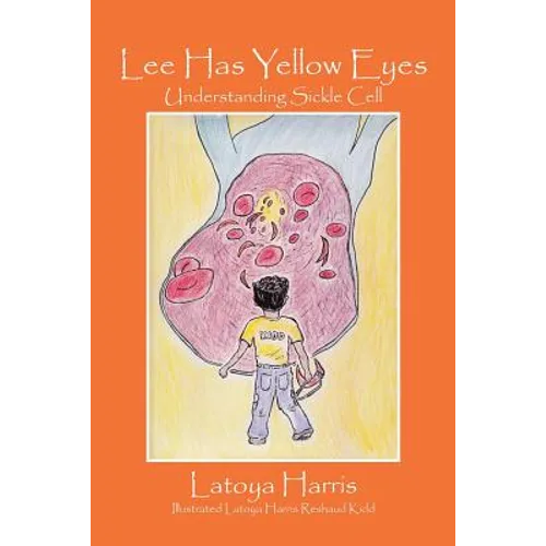 Lee Has Yellow Eyes: Understanding Sickle Cell
