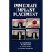 Immediate Implant Placement