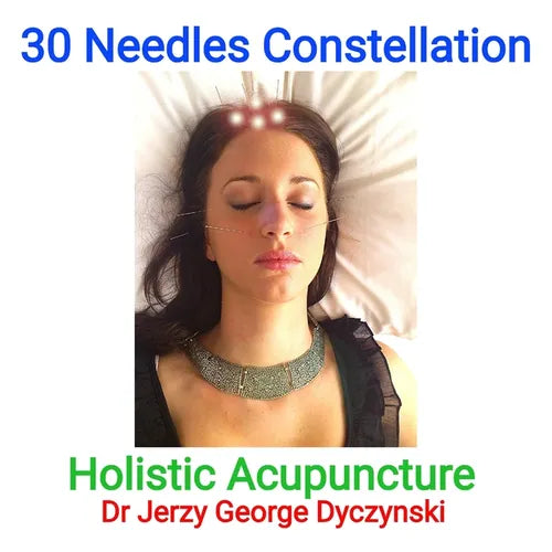 30 Needles Constellation Acupuncture: Holistic Acupuncture