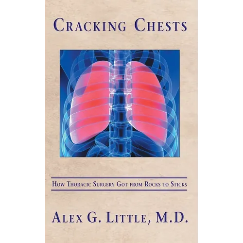 Cracking Chests: How Thoracic Surgery Got from Rocks to Sticks