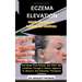 Eczema Elevation: Holistic Therapies For Soothing Skin Conditions: Find Relief From Eczema And Other Skin Conditions Through A Holistic