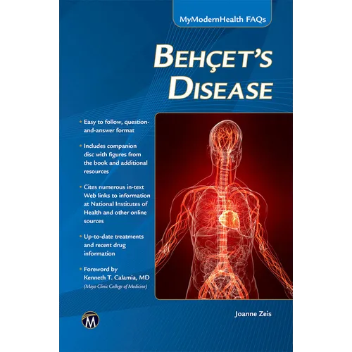 Behcet's Disease