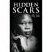 Hidden Scars: My Truth