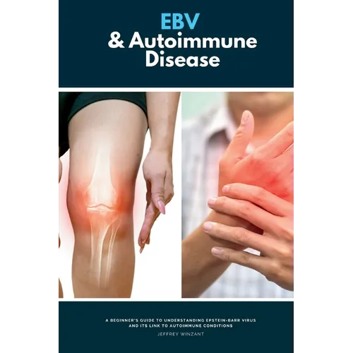 EBV & Autoimmune Disease: A Beginner's Guide to Understanding Epstein-Barr Virus and Its Link to Autoimmune Conditions