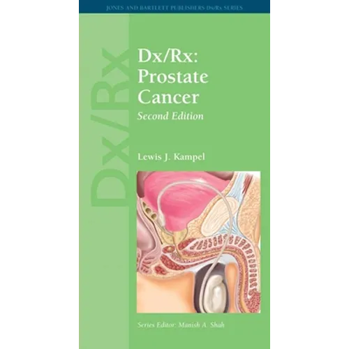 DX/Rx: Prostate Cancer: Prostate Cancer