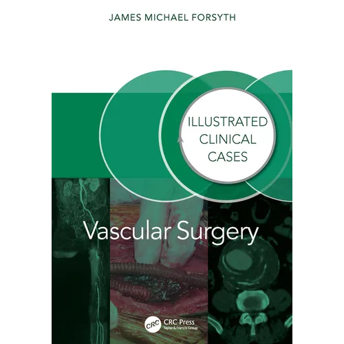 Vascular Surgery: Illustrated Clinical Cases