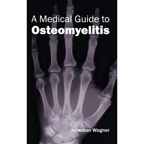 Medical Guide to Osteomyelitis