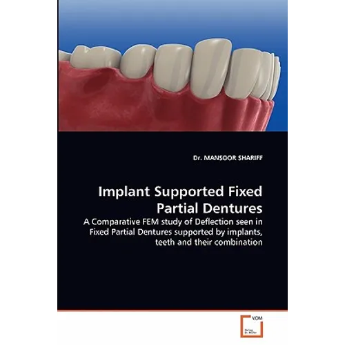 Implant Supported Fixed Partial Dentures