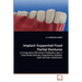 Implant Supported Fixed Partial Dentures