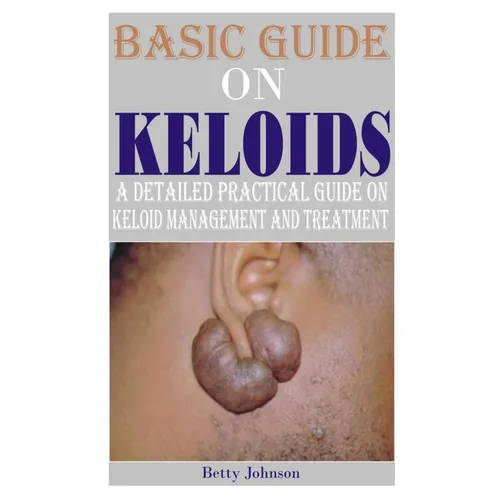 Basic Guide on Keloids: A detailed practical guide on keloid management and treatment