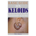 Basic Guide on Keloids: A detailed practical guide on keloid management and treatment