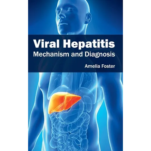 Viral Hepatitis: Mechanism and Diagnosis