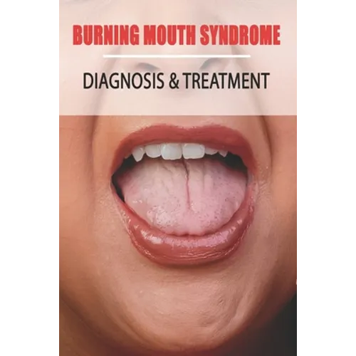 Burning Mouth Syndrome: Diagnosis & Treatment: Burning Mouth Syndrome Guide