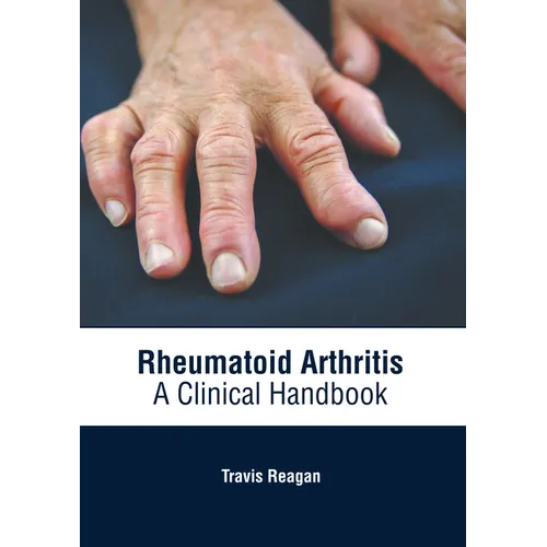 Rheumatoid Arthritis: A Clinical Handbook