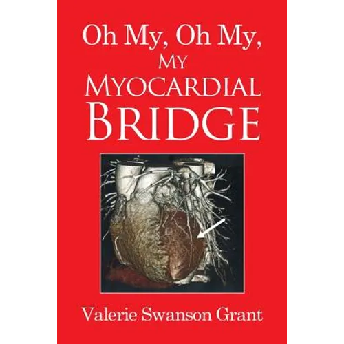 Oh My, Oh My, My Myocardial Bridge