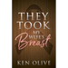 They Took My Wife's Breast