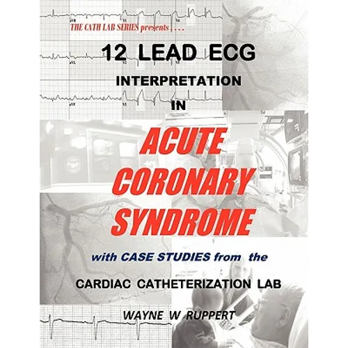 12 Lead ECG Interpretation in Acute Coronary Syndrome with Case Studies from the Cardiac Catheterization Lab
