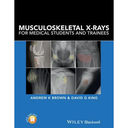 Musculoskeletal X-Rays for Medical Students and Trainees