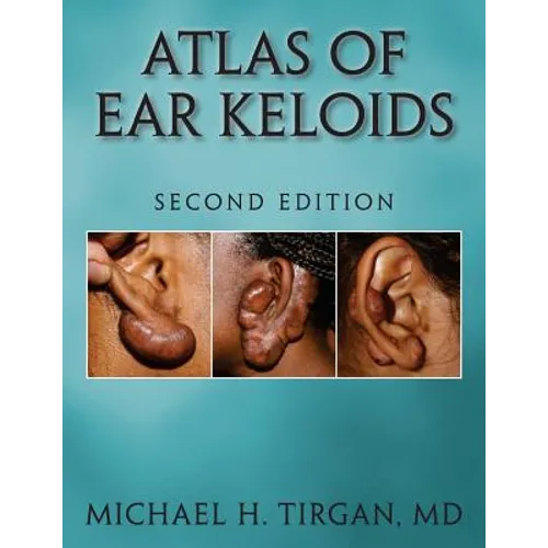 Atlas of Ear Keloids - Second Edition