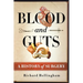 Blood and Guts: A History of Surgery
