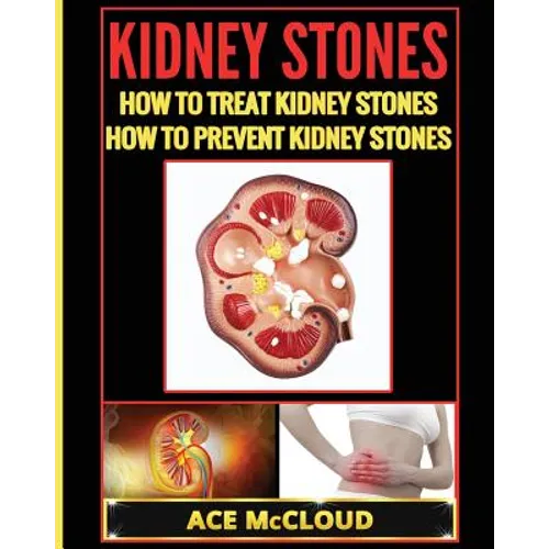 Kidney Stones: How To Treat Kidney Stones: How To Prevent Kidney Stones