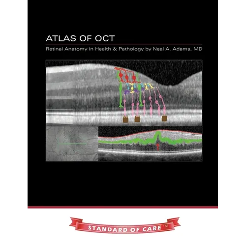 Atlas of OCT: Retinal Anatomy in Health & Pathology