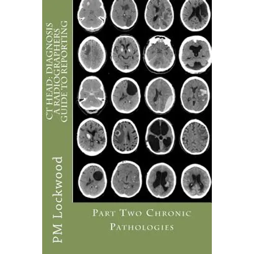CT Head: DIAGNOSIS A Radiographers Guide To Reporting Part 2 Chronic Pathologies: Part 2 Chronic Pathologies