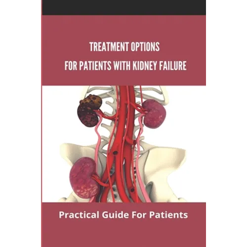 Treatment Options For Patients With Kidney Failure: Practical Guide For Patients: Pros And Cons Of Kidney Transplant