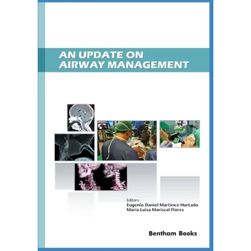 An Update on Airway Management