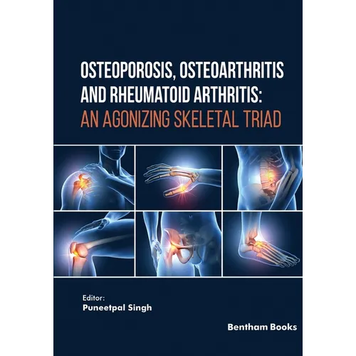 Osteoporosis, Osteoarthritis and Rheumatoid Arthritis: An Agonizing Skeletal Triad