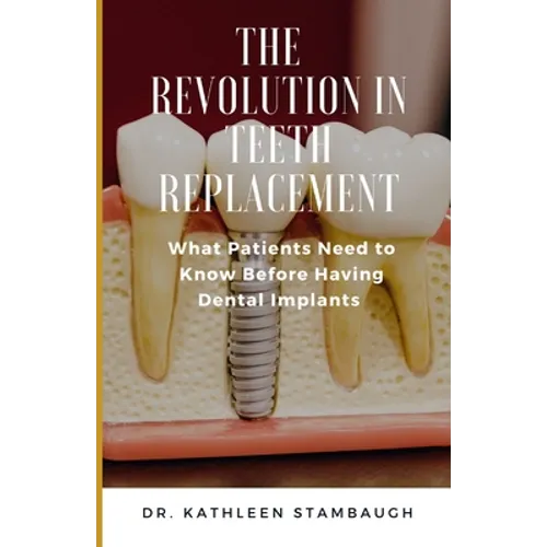 The Revolution in Teeth Replacement: What Patients Need to Know Before Having Dental Implants