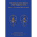 The Dislocated Brain: A New Perspective