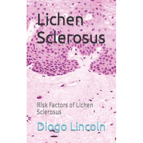 Lichen Sclerosus: Risk Factors of Lichen Sclerosus