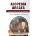 Alopecia Areata