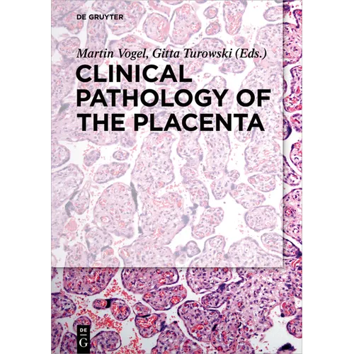 Clinical Pathology of the Placenta