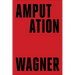 Amputation